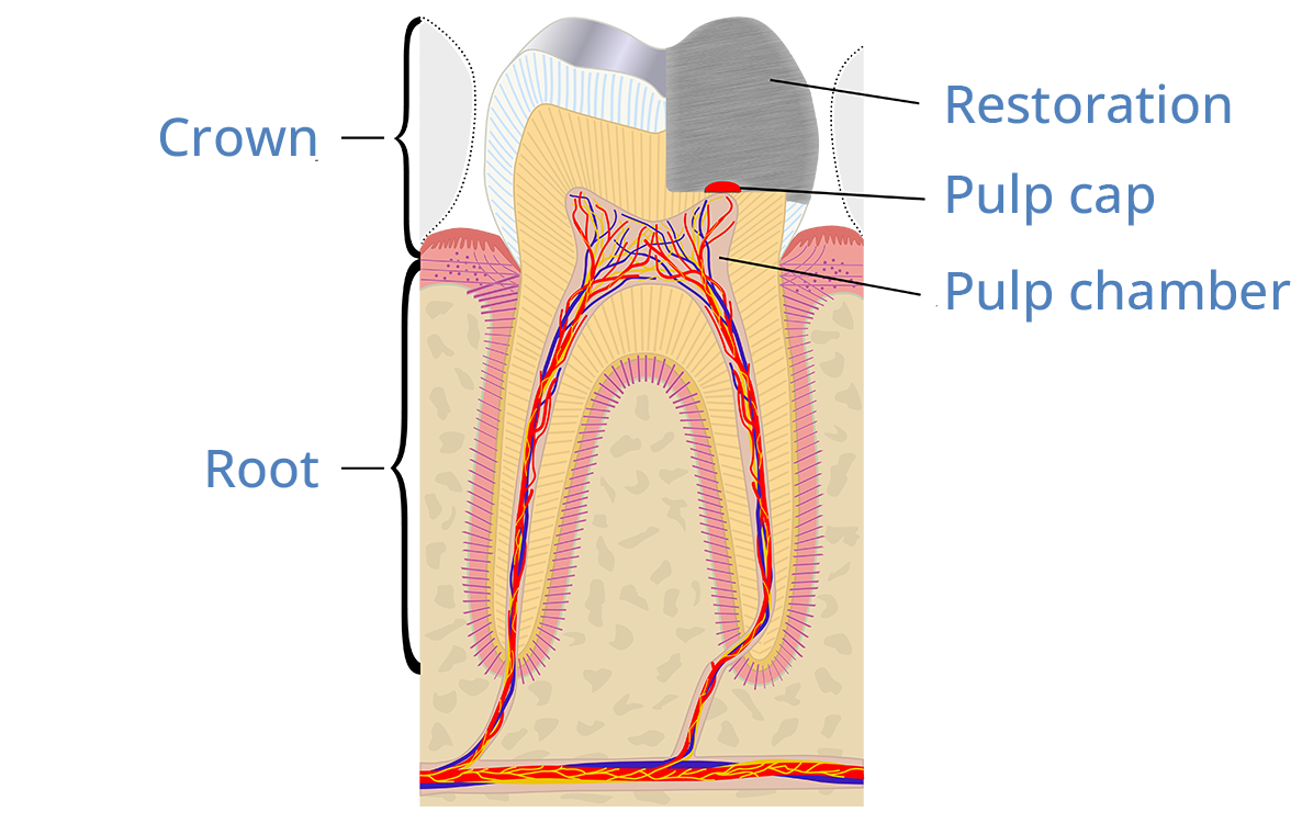 Pulp treatment | Pediatric Dentistry Center Philippines